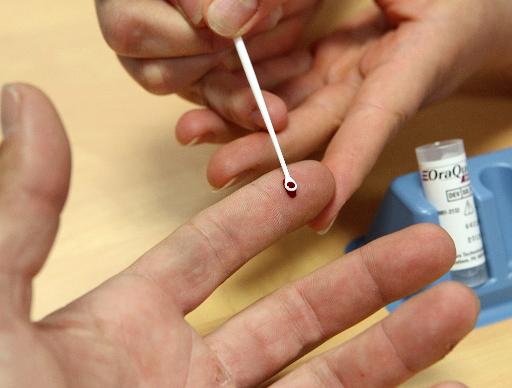 Teste de hepatite C é realizado em um hospital da França. Foto: AFP Francois Nascimbeni