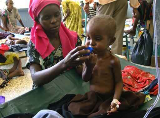 Mais de 38.000 crianças somalis correm o risco de morrer de fome, apesar de uma melhoria na situação nutricional no país. Foto: AFP Mustafa Abdi/