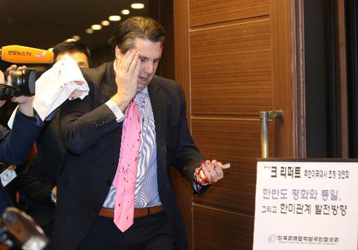 O embaixador dos Estados Unidos na Coreia do Sul, Mark Lippert, após ser atingido em Seul. Foto: YONHAP/AFP YONHAP() O embaixador dos Estados Unidos na Coreia do Sul, Mark Lippert, após ser atingido em Seul. Foto: YONHAP/AFP YONHAP/