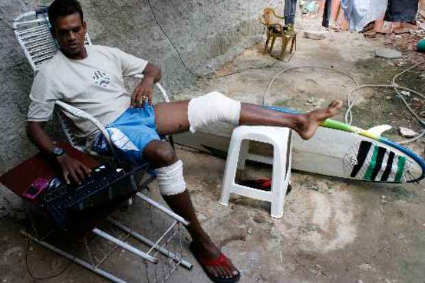 Jerônimo Pereira da Paz teve ferimentos graves na coxa esquerda e arranhões na perna direita. m Foto: Paulo Paiva/DP/D.A Press