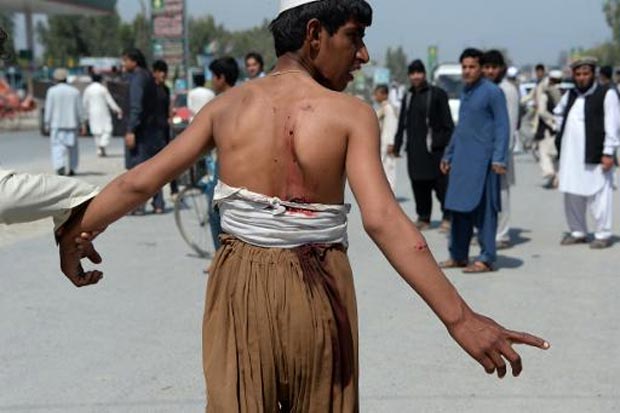 Homem ferido por atentado com carro-bomba na cidade de Jalalabad, leste do Afeganistão. Foto: Noorullah Shirzada/AFP() Homem ferido por atentado com carro-bomba na cidade de Jalalabad, leste do Afeganistão. Foto: Noorullah Shirzada/AFP/