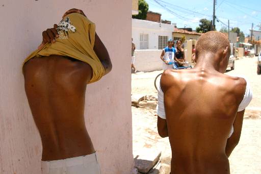 Meninos foram agredidos com cassetetes pelos Policiais Militares. Foto: Júlio Jacobina/DP/D.A Press/ Meninos foram agredidos com cassetetes pelos Policiais Militares. Foto: Júlio Jacobina/DP/D.A Press/