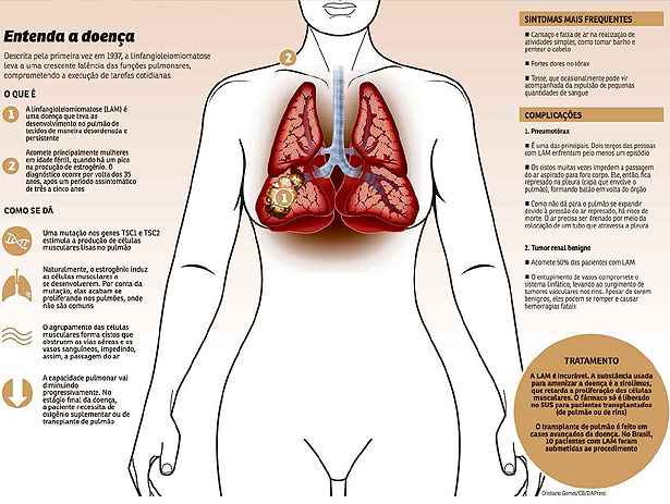 Clique na imagem para ampliá-la e saiba mais/ Clique na imagem para ampliá-la e saiba mais/
