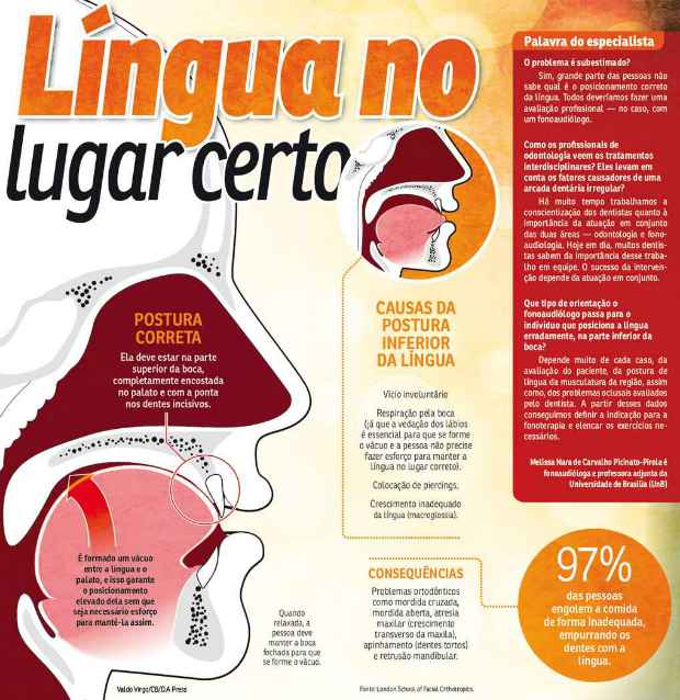 Clique na imagem para ampli&aacute;-la e saiba mais. Imagem: Valdo Virgo/CB/DA Press/