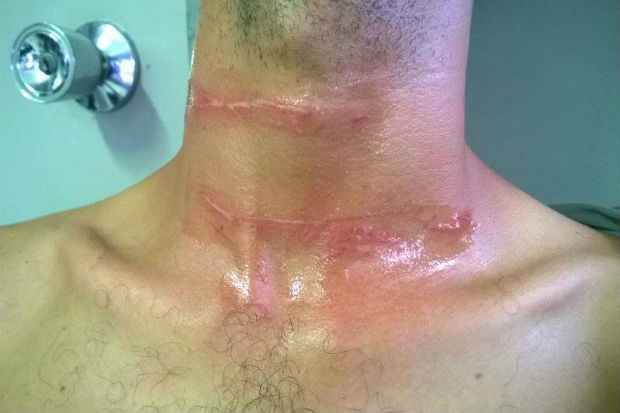 Motociclista de 31 anos foi atingido na altura do pescoço. Foto: Reprodução/ Facebook
