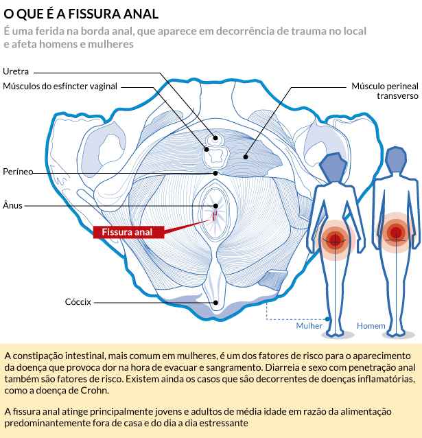 /Arte: Soraia Piva/EM/DA Press /Arte: Soraia Piva/EM/DA Press