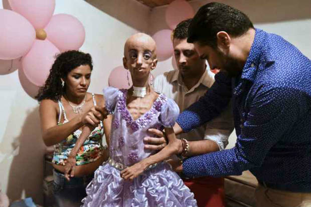 Magali tem 15 anos e os ossos têm cerca de 90 Foto: Luis Romayo/AFP/ Magali tem 15 anos e os ossos têm cerca de 90 Foto: Luis Romayo/AFP/