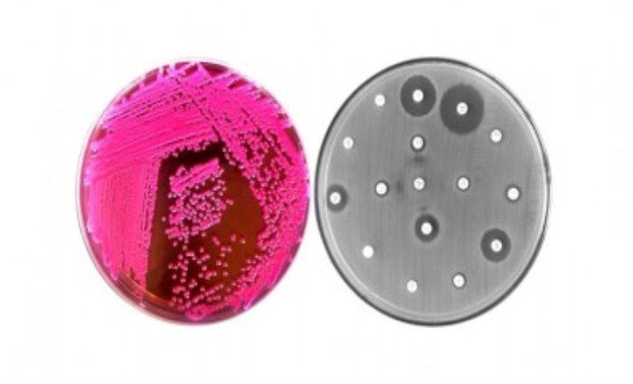 Cepas bacterianas carregando o gene mcr-1 foram encontradas tanto em animais de produ&ccedil;&atilde;o como em seres humanos. Foto: Reprodu&ccedil;&atilde;o./
