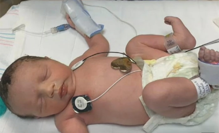 Lynlee "nasceu pela segunda vez" em 6 de junho, através de uma cesariana feita próximo do fim da gravidez. Ela veio ao mundo saudável e pesando 2,4 kg. Foto: Youtube/Reprodução/