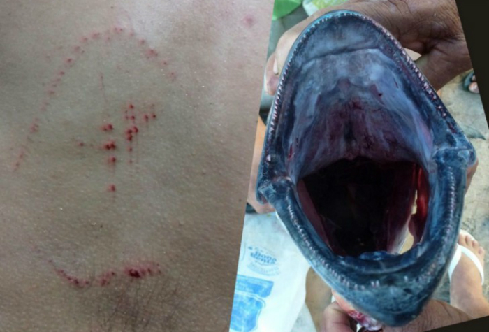 Comparativo do ferimento com a mordida do atum. Foto: Léo Veras/Reprodução