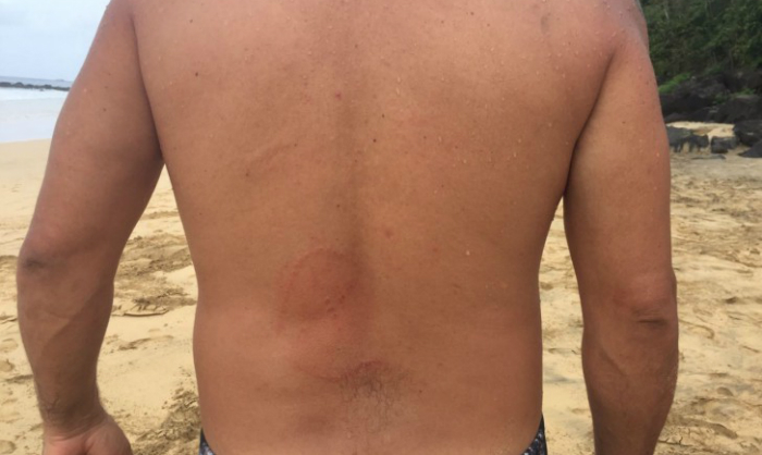 Turista chegou a pensar que fosse um ataque de tubar&atilde;o. Foto: Ana Clara Marinho/TV Globo/Reprodu&ccedil;&atilde;o/Turista chegou a pensar que fosse um ataque de tubar&atilde;o. Foto: Ana Clara Marinho/TV Globo/Reprodu&ccedil;&atilde;o