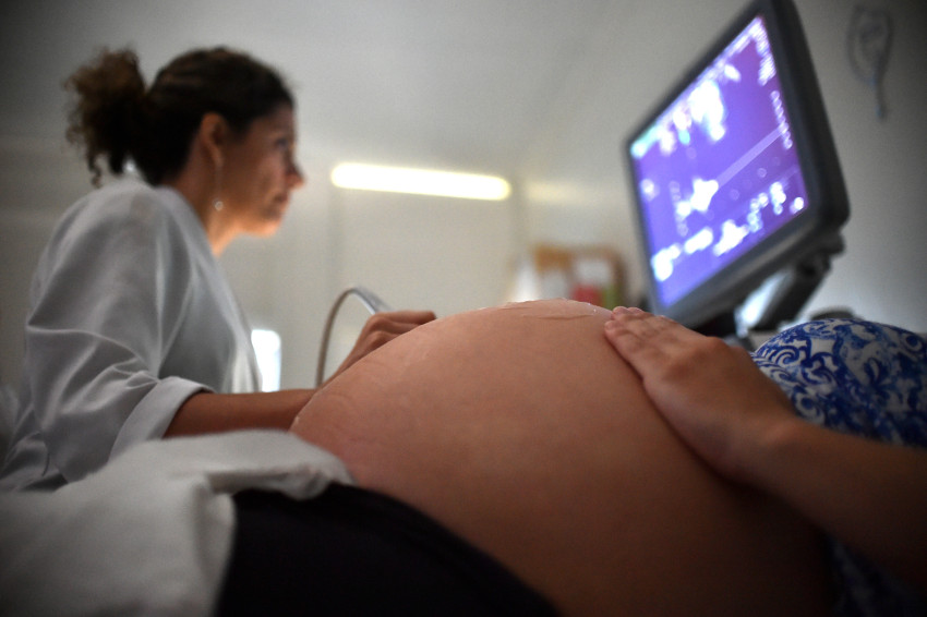 A inser&ccedil;&atilde;o do DIU no p&oacute;s-parto imediato, tanto do parto normal quanto na cesariana, &eacute; comum em outros pa&iacute;ses. Foto: Andr&eacute; Borges/Ag&ecirc;ncia Bras&iacute;lia/