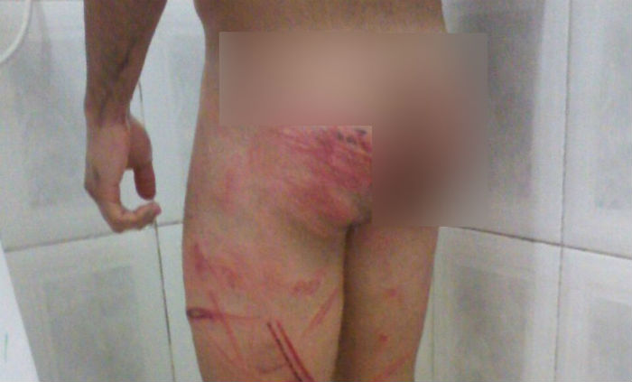 De acordo com os relatos do jovem, que era calouro na época das agressões, as torturas eram recorrentes. Foto: Reprodução/Arquivo Pessoal/De acordo com os relatos do jovem, que era calouro na época das agressões, as torturas eram recorrentes. Foto: Reprodução/Internet De acordo com os relatos do jovem, que era calouro na época das agressões, as torturas eram recorrentes. Foto: Reprodução/Arquivo Pessoal/De acordo com os relatos do jovem, que era calouro na época das agressões, as torturas eram recorrentes. Foto: Reprodução/Internet
