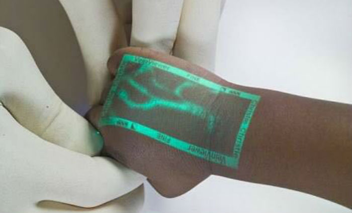 Equipamento inovador permite localizar veias das crian&ccedil;as, facilitando hemogramas e acessos para medica&ccedil;&atilde;o intravenosa. Foto: Divulga&ccedil;&atilde;o/