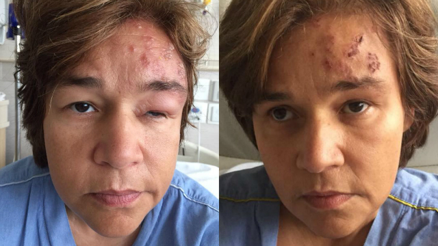 Atriz divulgou imagens da evolu&ccedil;&atilde;o do tratamento nas redes sociais. Foto: Facebook/Reprodu&ccedil;&atilde;o/