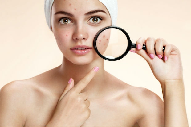 Higienizar a pele antes de dormir pode ajudar na luta contra o aparecimento da acne. Foto: Reprodução/Internet/ Higienizar a pele antes de dormir pode ajudar na luta contra o aparecimento da acne. Foto: Reprodução/Internet/