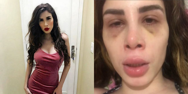 Camilla afirma estar sofrendo de problema de aceitação: "Não consigo me olhar no espelho". Fotos: Instagram/Reprodução/ Camilla afirma estar sofrendo de problema de aceitação: "Não consigo me olhar no espelho". Fotos: Instagram/Reprodução/