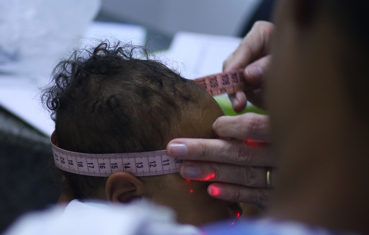 Um conjunto de alterações genéticas é responsável por aumentar a suscetibilidade de alguns bebês às consequências neurológicas da infecção/Marlon Diego / Esp. DP