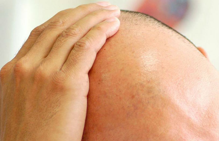 Foto: Carlos Vieira/CB/D.A Press/