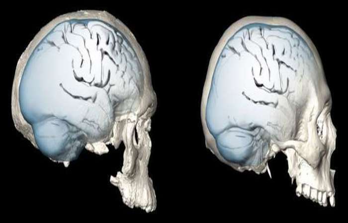 Tomografia do crânio de um homem moderno (direita) e do Homo sapiens há 300 mil anos: mudanças deram vantagens cognitivas
(foto: Simon Neubauer, MPI EVA Leipzig/Divulgação)/