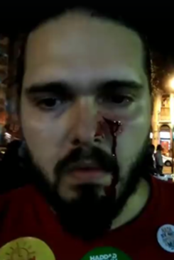 Segundo o professor de história que foi agredido, a violência partiu de um eleitor de Jair Bolsonaro. Foto: Reprodução/Facebook/ Segundo o professor de história que foi agredido, a violência partiu de um eleitor de Jair Bolsonaro. Foto: Reprodução/Facebook/
