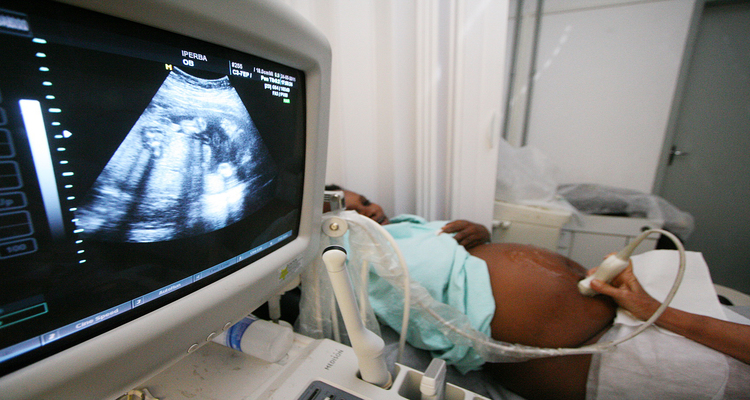 Na pesquisa, filhos de grávidas com obesidade tinham em média 100g a mais e ossos do corpo maiores. Foto: Mateus Pereira/SECOM/ Na pesquisa, filhos de grávidas com obesidade tinham em média 100g a mais e ossos do corpo maiores. Foto: Mateus Pereira/SECOM/