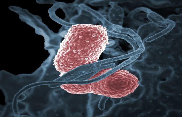 Imagem feita por microsc&oacute;pio eletr&ocirc;nico e colorizada por computador, mostrando a bact&eacute;ria Klebsiella pneumoniae interagindo com uma c&eacute;lula humana. Foto: NIAID/ Direitos Reservados/