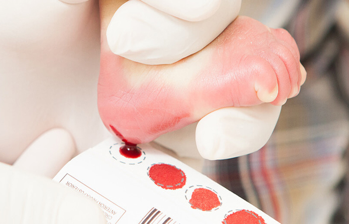 Foto: Ascom/PMI/ Foto: Ascom/PMI/