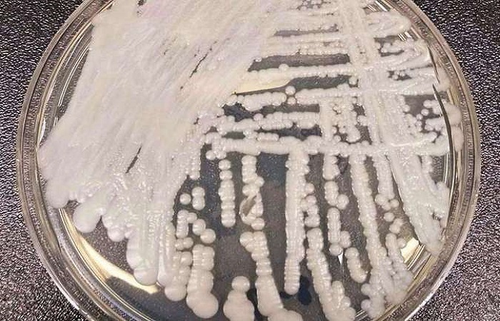 O superfungo Candida auris se prolifera quando o sistema imunológico está debilitado: transmissão por contato. FOTO: CDC/Divulgação/O superfungo Candida auris se prolifera quando o sistema imunológico está debilitado: transmissão por contato. FOTO: CDC/Divulgação O superfungo Candida auris se prolifera quando o sistema imunológico está debilitado: transmissão por contato. FOTO: CDC/Divulgação/O superfungo Candida auris se prolifera quando o sistema imunológico está debilitado: transmissão por contato. FOTO: CDC/Divulgação