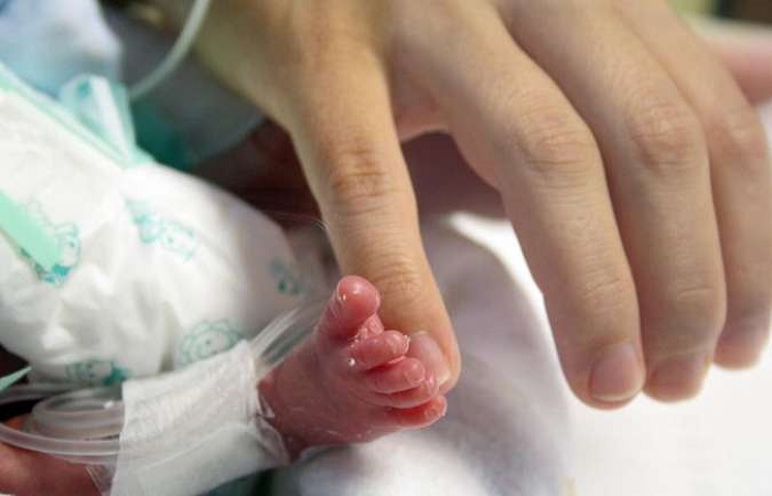 Nascidos antes da 32ª semana gestacional, os microprematuros pesam menos de 1,5kg: benefícios neurológicos sob todos os aspectos avaliados pelos especialistas. Foto: Monique Renne/Esp. CB/D.A Press/Nascidos antes da 32ª semana gestacional, os microprematuros pesam menos de 1,5kg: benefícios neurológicos sob todos os aspectos avaliados pelos especialistas. Foto: Monique Renne/Esp. CB/D.A Press Nascidos antes da 32ª semana gestacional, os microprematuros pesam menos de 1,5kg: benefícios neurológicos sob todos os aspectos avaliados pelos especialistas. Foto: Monique Renne/Esp. CB/D.A Press/Nascidos antes da 32ª semana gestacional, os microprematuros pesam menos de 1,5kg: benefícios neurológicos sob todos os aspectos avaliados pelos especialistas. Foto: Monique Renne/Esp. CB/D.A Press