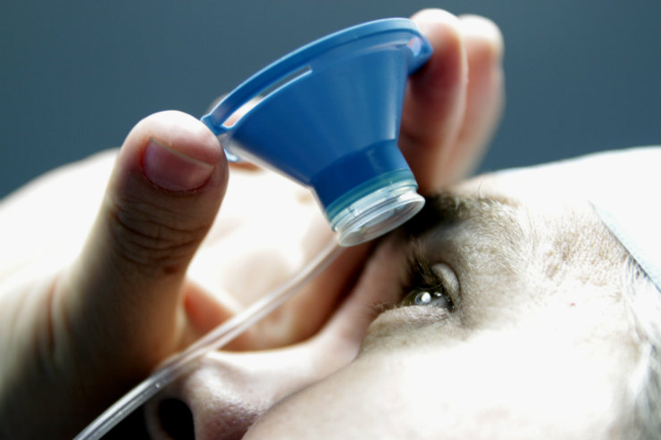 Caracterizada pela opacificação do cristalino do olho, lente natural responsável por propiciar o foco da visão, a catarata pode afetar apenas um dos olhos ou ambos. Foto: Arquivo DP