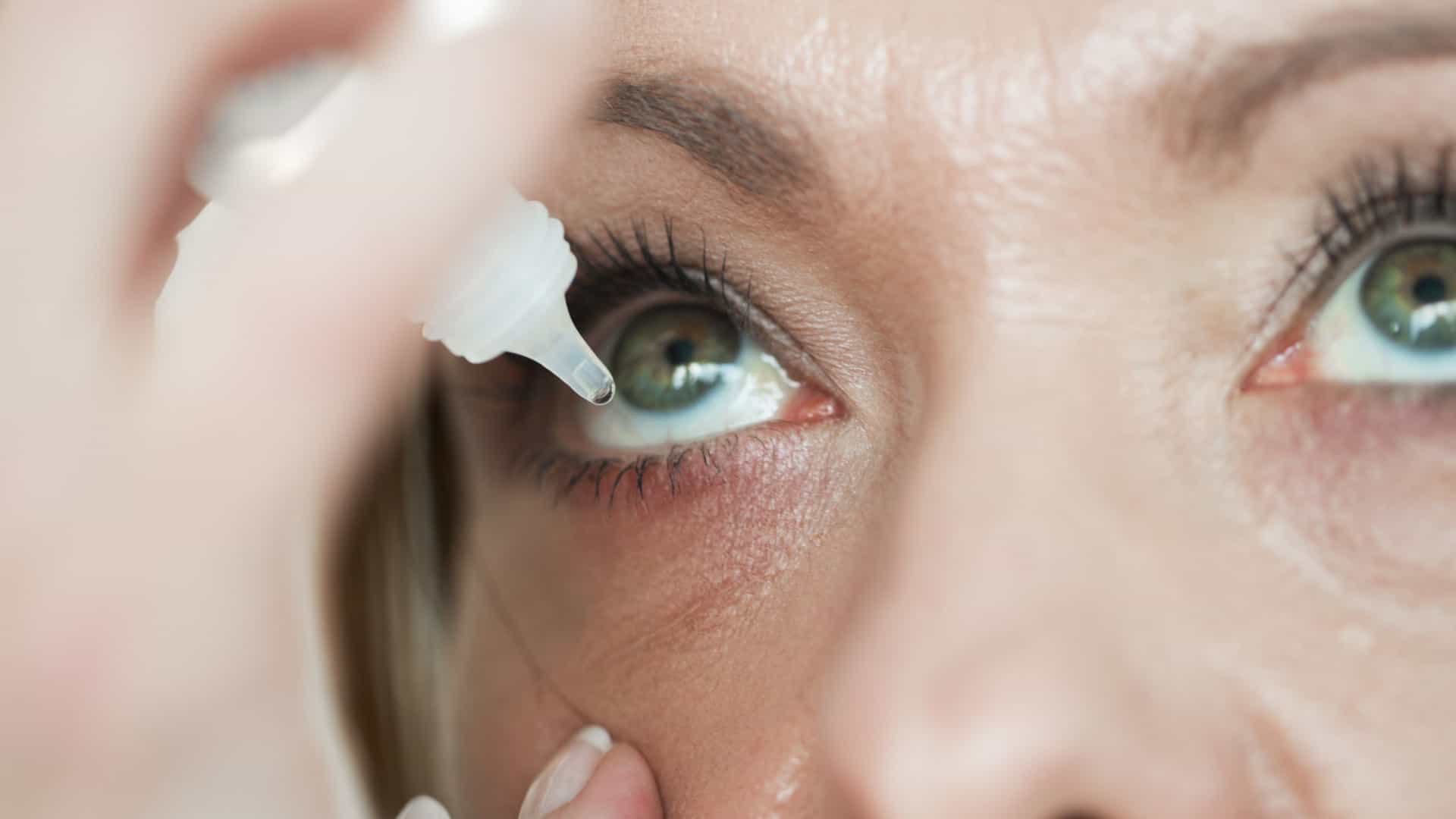 Síndrome do Olho Seco se caracteriza pela falta de lubrificação nos olhos. Foto: Reprodução da internet/ Síndrome do Olho Seco se caracteriza pela falta de lubrificação nos olhos. Foto: Reprodução da internet/