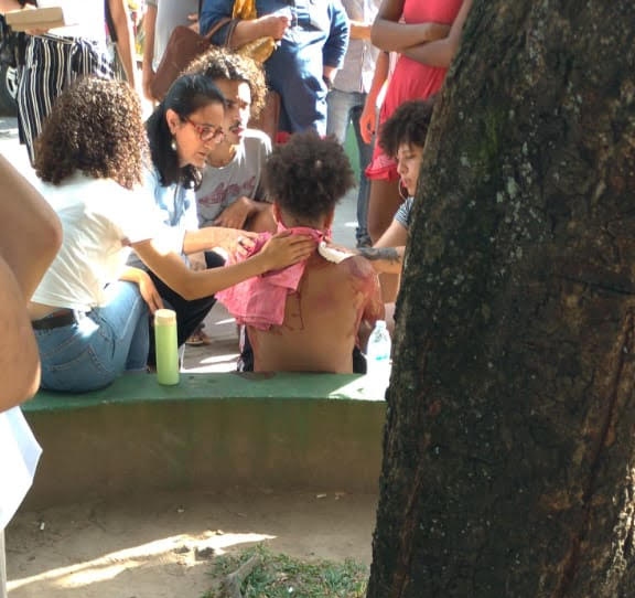V&iacute;tima recebeu primeiro atendimento ainda no Centro de Educa&ccedil;&atilde;o. Foto: WhatsApp/Reprodu&ccedil;&atilde;o/