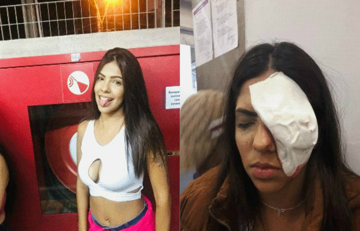 Segunda a mãe, a jovem retornava para a adega quando uma viatura da PM passou ao lado da adolescente e atirou contra a jovem com uma arma de bala de borracha/Foto: Reprodução/Facebook/Arquivo pessoal Segunda a mãe, a jovem retornava para a adega quando uma viatura da PM passou ao lado da adolescente e atirou contra a jovem com uma arma de bala de borracha/Foto: Reprodução/Facebook/Arquivo pessoal