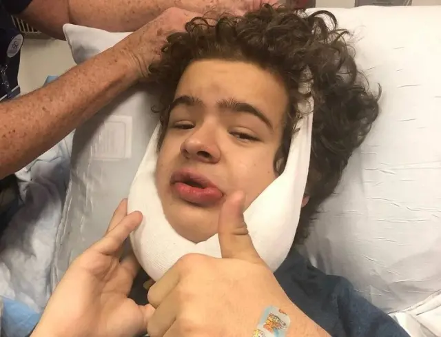 Em seu conta do Instagram Gaten, que tem 17 anos, publicou uma foto após a cirurgia e deu detalhes sobre o procedimento/Foto: Reprodução/Instagram Em seu conta do Instagram Gaten, que tem 17 anos, publicou uma foto após a cirurgia e deu detalhes sobre o procedimento/Foto: Reprodução/Instagram