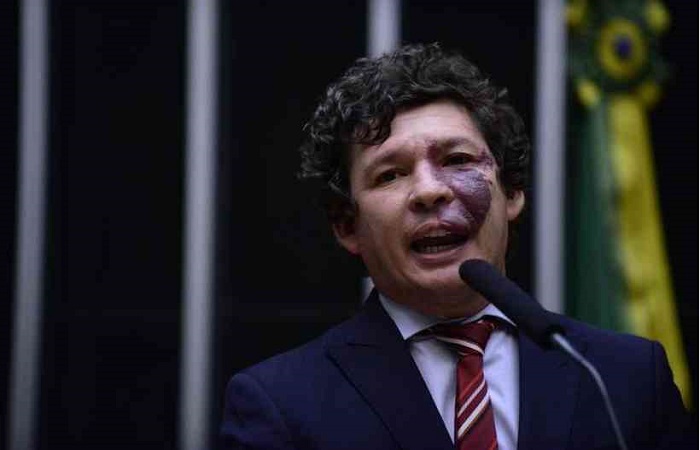 Deputado Reginaldo Lopes: ''Muitos gastos públicos serão feitos sem licitação (...), precisamos saber como estão sendo feitos esses gastos''/Foto: Nilson Bastian/ Câmara dos Deputados Deputado Reginaldo Lopes: ''Muitos gastos públicos serão feitos sem licitação (...), precisamos saber como estão sendo feitos esses gastos''/Foto: Nilson Bastian/ Câmara dos Deputados