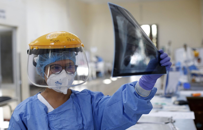 /Foto: Peruvian Ministry of Health/AFP /Foto: Peruvian Ministry of Health/AFP