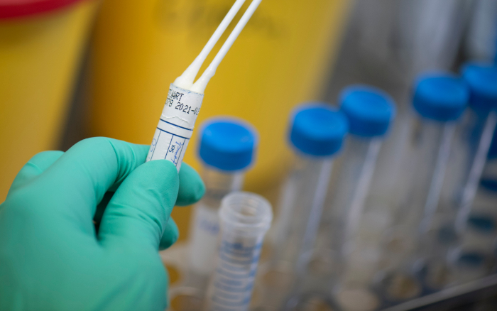 /Foto: Thomas Kienzle/AFP