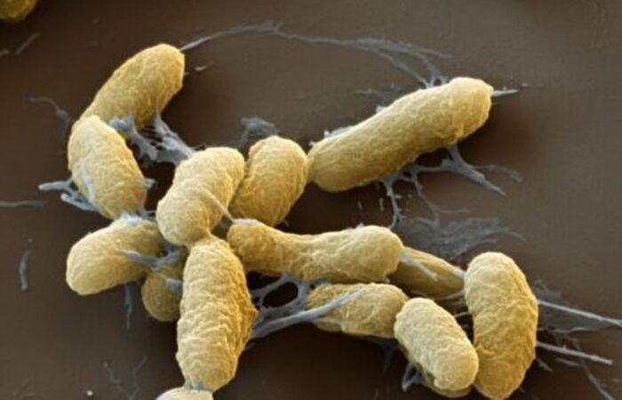 A bactéria Yersinia pestis, causadora da peste bubônica/Foto: Reprodução/Organização Pan-Americana da Saúde A bactéria Yersinia pestis, causadora da peste bubônica/Foto: Reprodução/Organização Pan-Americana da Saúde