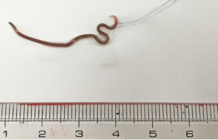 /Foto: Reprodução/The American Journal of Tropical Medicine and Hygiene /Foto: Reprodução/The American Journal of Tropical Medicine and Hygiene