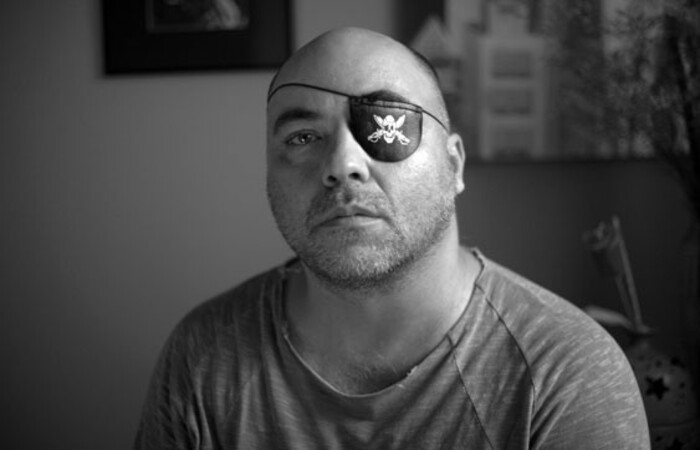 Alex Silveira perdeu a visão após ser atingido por bala de borracha durante protesto em São Paulo há duas décadas/Foto: Sérgio Silva/Divulgação - Imagem da Série Piratas Urbanos Alex Silveira perdeu a visão após ser atingido por bala de borracha durante protesto em São Paulo há duas décadas/Foto: Sérgio Silva/Divulgação - Imagem da Série Piratas Urbanos