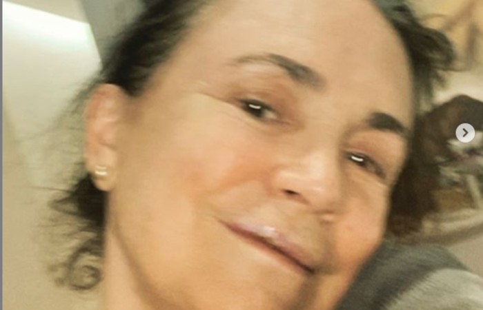 Atriz sofreu acidente e publicou relato em seu perfil no Instagram/Foto: Reprodução / Instagram Atriz sofreu acidente e publicou relato em seu perfil no Instagram/Foto: Reprodução / Instagram