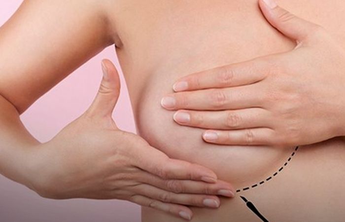 /Foto: Divulgação/Sociedade Brasileira de Mastologia
