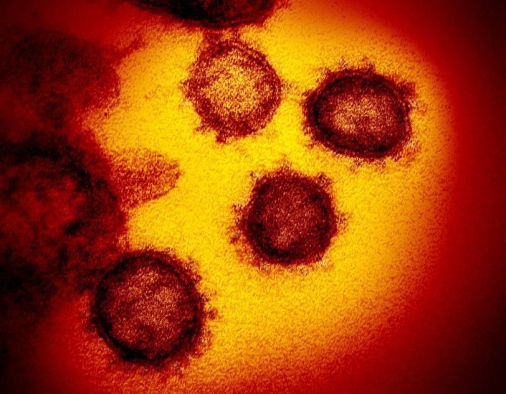 /Foto: AFP / National Institutes of Health / Handout /Foto: AFP / National Institutes of Health / Handout
