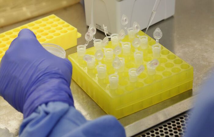 HIV atinge 38 milhões de pessoas em todo o mundo/Divulgação/Josué Damascena (IOC/Fiocruz)