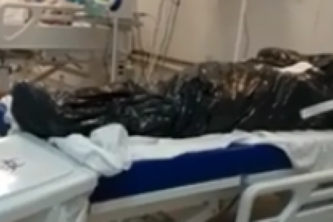 /Caso ocorreu na UTI do Hospital de Santa Maria. Foto: Material cedido ao Correio