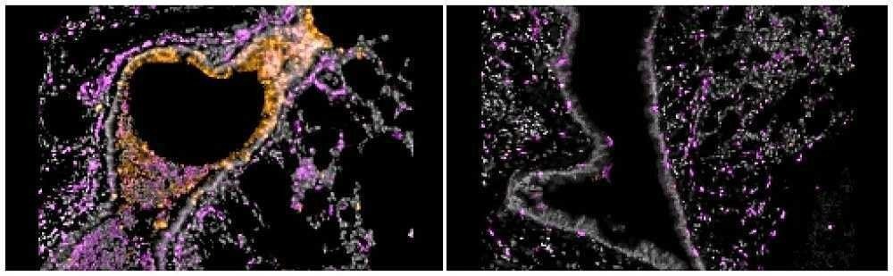 /As células de defesa artificiais reduzem a presença do Sars-CoV-2 no corpo das cobaias em um milhão de vezes. Foto: Nambulli et al./Science Advances /As células de defesa artificiais reduzem a presença do Sars-CoV-2 no corpo das cobaias em um milhão de vezes. Foto: Nambulli et al./Science Advances
