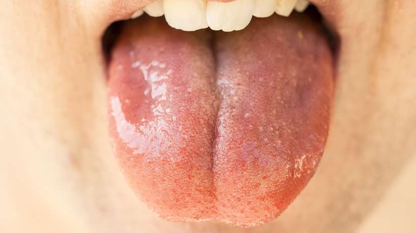 /Estudo traz uma resposta para a transmiss&atilde;o da Covid-19 por pacientes assintom&aacute;ticos, haja vista a infec&ccedil;&atilde;o por got&iacute;culas presentes na fala, afirma pesquisador. Foto: Reprodu&ccedil;&atilde;o/Pixabay