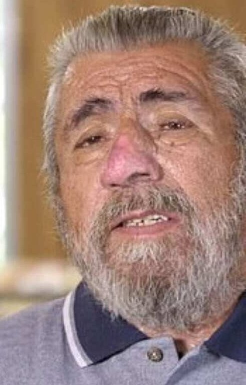 Roger depois da cirurgia
