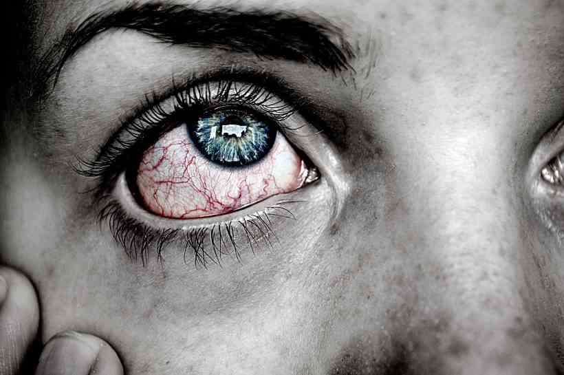 /Este &eacute; um desequil&iacute;brio na composi&ccedil;&atilde;o ou produ&ccedil;&atilde;o das l&aacute;grimas, que pode gerar problemas na vis&atilde;o. At&eacute; 34% da popula&ccedil;&atilde;o mundial apresenta a condi&ccedil;&atilde;o. Foto: Reprodu&ccedil;&atilde;o/Pixabay